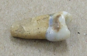 这是人类的牙齿，很可能是婴儿牙。发现此物品的袋子被标记为“智人”。该牙齿看起来也与Ronson Ship Collection中发现的其他牙齿大不相同。